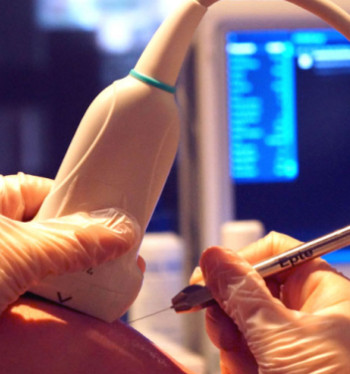 Electrólisis percutánea