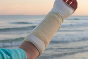 Lesiones más comunes en verano: Cómo prevenirlas y tratarlas