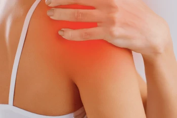 ¿Qué es la Bursitis y cómo prevenirla?