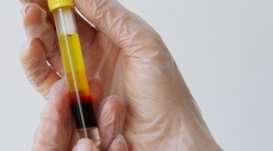 Suero Rico en Factores